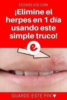 herpes en los brazos causas