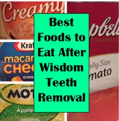 Foods To Eat After Having All Teeth Pulled Foods To Eat After Having All Teeth Pulled