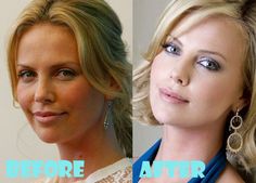charlize theron plastic surgery