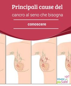 cancro della prostata chez la femme sintomo cancro della prostata chez la femme sintomo