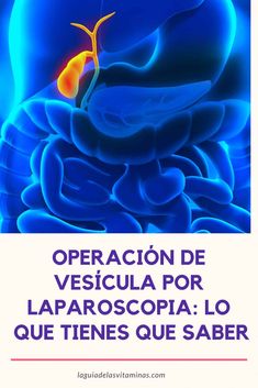 dietas para afinarse para personas sin vesicula