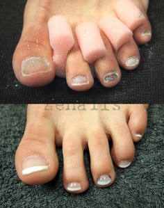 Kynsistudio Zenails Linda On Pinterest Lcn Wilde Pedique Before And After Kynsistudio Zenails