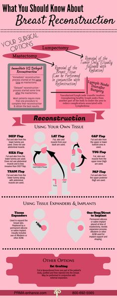 breast reconstruction information Male gay photo galleries