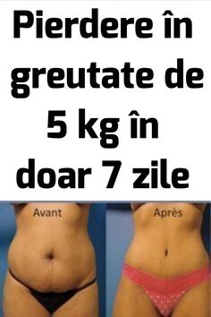 cum să îndepărtați grăsimea de la burtă
