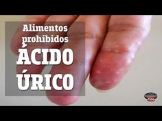 Remedios Caseros Para Bajar El Acido Urico
