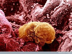10 Ideas De Embrion Embrion Microscopio Electronico De Barrido Fotografía Microscópica