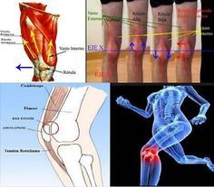 19 Ideas De Condromalacia Ejercicios Para Rodillas Condromalacia Condromalacia Rotuliana