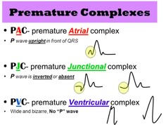 Premature Ventricular Contractions Natural Remedies Premature Ventricular Contractions Natural Remedies