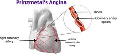 pa emt practice test pa emt practice test
