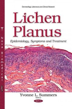 How To Cure Lichen Sclerosus Naturally How To Cure Lichen Sclerosus Naturally
