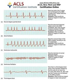 ekg whos naturally good at em no one its learned and needs acls drug cheat sheet