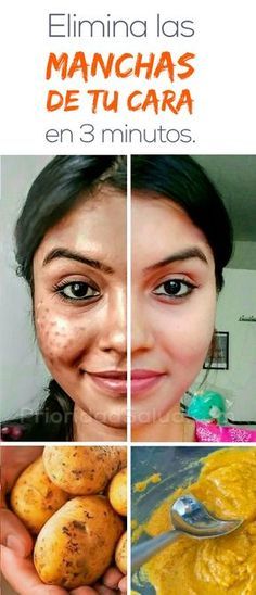 Como eliminar las marcas rojas de acne Como eliminar las marcas rojas de acne