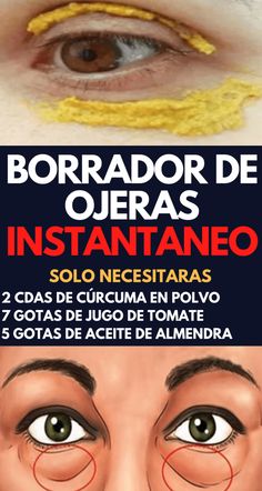 10 Ideas De Aceites Remedios Para La Salud Cremas Faciales Caseras Consejos Para La Salud