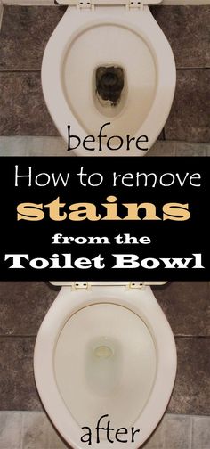 The Best Way to Remove Toilet Bowl Rings | Toilet bowl ring ... The Best Way to Remove Toilet Bowl Rings | Toilet bowl ring ...