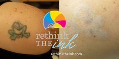 http www thriveportland com tattoo removal index html tattoo http www thriveportland com tattoo removal index html tattoo