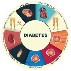 síntomas de diabetes proargi 9 síntomas de diabetes proargi 9