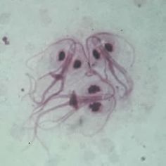 chisturi de ou de helminth lamblia