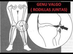 Pin En Exercícios De Treino