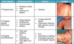 9 Best Burn Injuries Images Medical Conditions Medicine Trauma Burn Service Kaiser Permanente