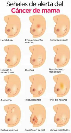 hace falta de nutrición adecuada lío con color de semen