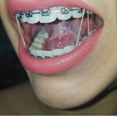 Consider, what Girls with braces having oral sex Girls with braces having oral sex believe, that