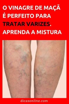 Safena ensinar anatomia me veia