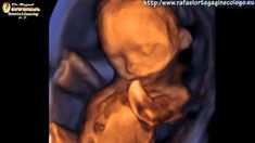 900 Ideas De Ecografia 4d Hd Live 3d 2d Doppler Color Diagnóstico Prenatal Prenatal Embarazo