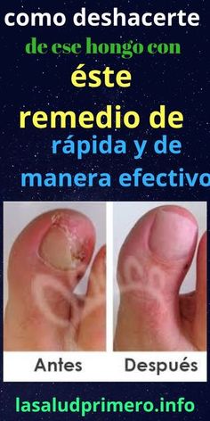 27 Ideas De Cosas Para Comprar Consejos Para La Salud Remedios Remedios Naturales