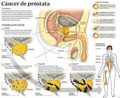 folleto de pacientes con cáncer de próstata