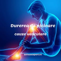 ce fel de cultură fizică în varicoză