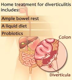 How To Treat Norovirus Naturally How To Treat Norovirus Naturally