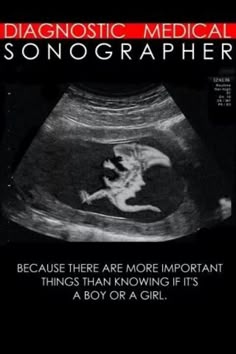 128 Best Sonography Jokes Sayings Images Ultrasound Humor Work