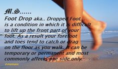 dieta drop foot dieta drop foot