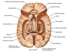 agenesia del corpo calloso isolate 1