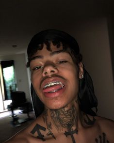 like a lollipop boy crazy cute braces colors for light skins