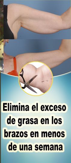 como quitar el exceso de grasa en los brazos como quitar el exceso de grasa en los brazos