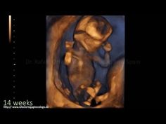 900 Ideas De Pregnant Ultrasound Diagnóstico Prenatal Prenatal Embarazo