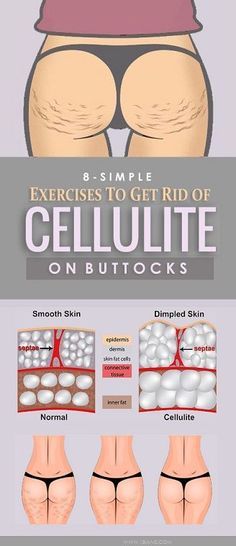 Burn That Cellulite Fast and Rapid With This Workout Sheet for - workout sheet Burn That Cellulite Fast and Rapid With This Workout Sheet for - workout sheet