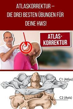 Kann sich ein Halswirbel verschieben? Kann sich ein Halswirbel verschieben?