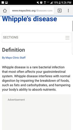 clinica di dieta mayo gallstoness