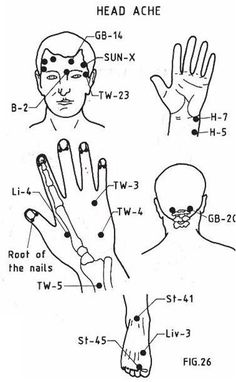 color acupressure points for migraines balancedwomensblog com yes pressure points for migraines