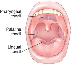 tonsil_size3 gif 730 x 660 tonsil sizes pictured pinterest tonsil size