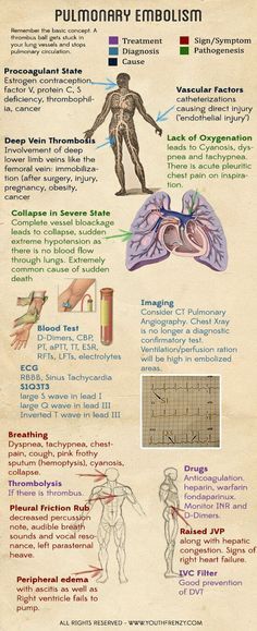acute renal failure cause, diagnosis, pathogenesis, signs and
