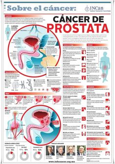 hiperplasia de próstata jelentéses