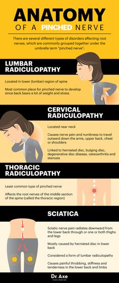 pinched nerve in neck pinched nerve in neck