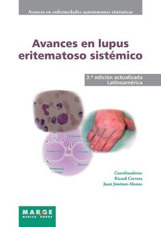 Avances en síndrome antifosfolipídico (Spanish Edition)