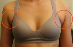 How To Get Rid Of Fat Lumps Under Skin Naturally How To Get Rid Of Fat Lumps Under Skin Naturally