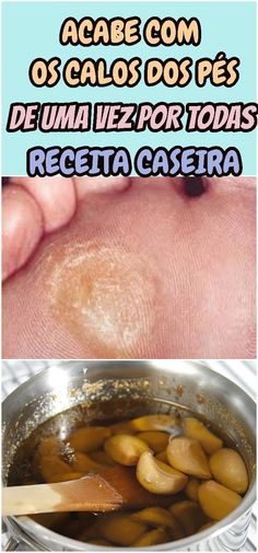 Que ponerse en dedo machucado