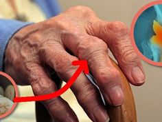 Pálinkás Rita Gyógytornász bemutatkozása