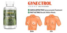 pierderea grăsimilor gynecomastia